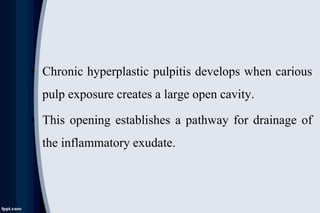 • Chronic hyperplastic pulpitis develops when carious
pulp exposure creates a large open cavity.
• This opening establishes a pathway for drainage of
the inflammatory exudate.
 