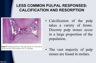 LESS COMMON PULPAL RESPONSES:
CALCIFICATION AND RESORPTION
• Calcification of the pulp
takes a variety of forms.
Discrete pulp stones occur
in a large proportion of the
population.
• The vast majority of pulp
stones are found in molars.
 
