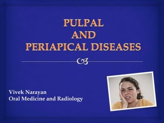 Vivek Narayan
Oral Medicine and Radiology
 
