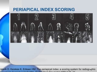PERIAPICAL INDEX SCORING
rstavik D, Kerekes K, Eriksen HM. The periapical index: a scoring system for radiographic96
 
