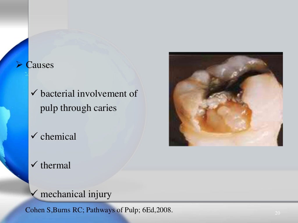 Pulpal & periradicular diseases & their diagnosis