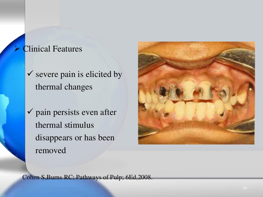 Pulpal & periradicular diseases & their diagnosis