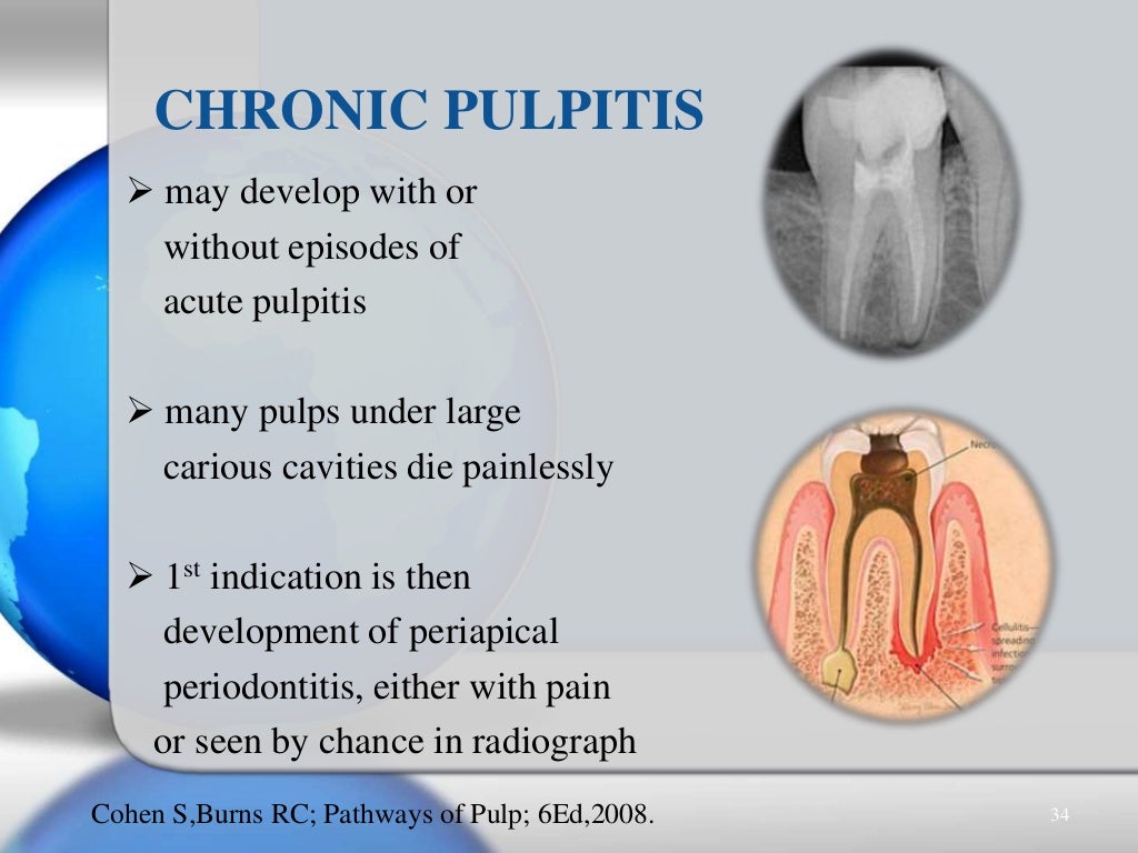 Pulpal & periradicular diseases & their diagnosis
