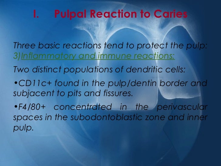 Pulpal reactions to caries and dental procedures
