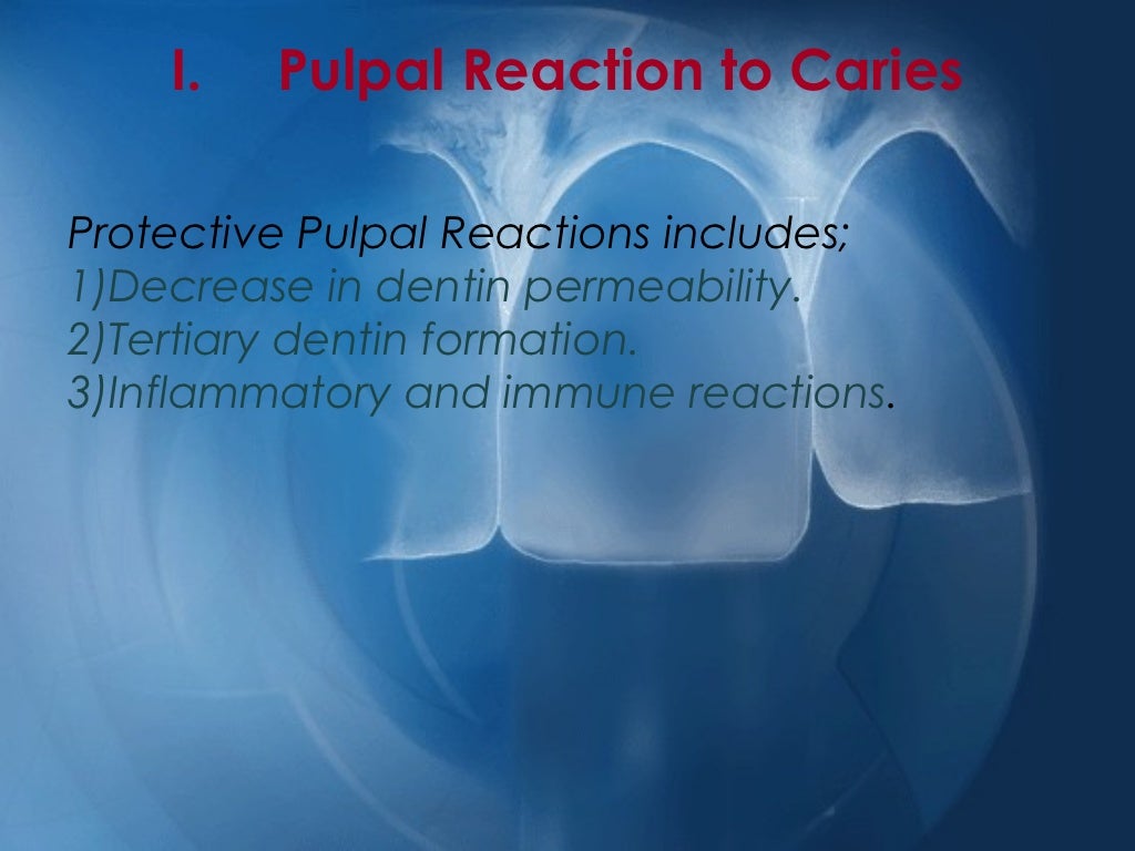 Pulpal reactions to caries and dental procedures