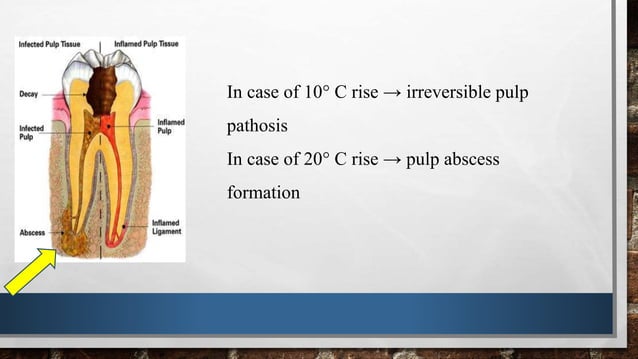 Pulpak Patch Pulpal reactions to various stimuli | PPTX