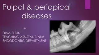 Pulpal & periapical
diseases
BY
DIAA ELDIN
TEACHING ASSISTANT, NUB
ENDODONTIC DEPARTMENT
 