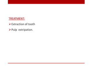PULP AND PERIAPICAL LESIONS OF THE TOOTH ppt | PPTX