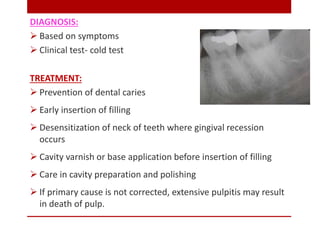 DIAGNOSIS:
 Based on symptoms
 Clinical test- cold test
TREATMENT:
 Prevention of dental caries
 Early insertion of fi...