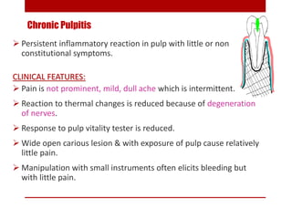 Chronic Pulpitis
 Persistent inflammatory reaction in pulp with little or non
constitutional symptoms.
CLINICAL FEATURES:...