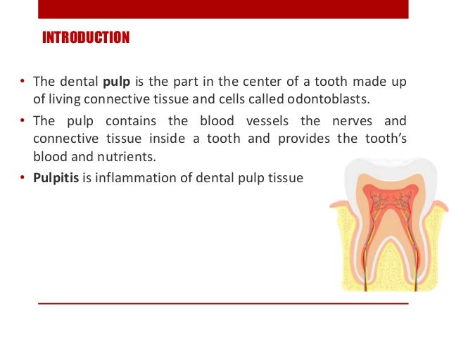 Pulp And Periapical Lesions Of The Tooth Ppt