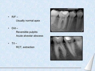 • R/F –
Usually normal apex
• D/d –
Reversible pulpitis
Acute alveolar abscess
• T/t –
RCT, extraction
 