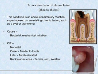 • R/F –
Large periapical radiolucency
Well defined or diffuse
• D/d –
Acute apical abscess
• T/t –
Drainage to be establis...