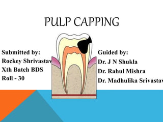 PULP CAPPING
Submitted by:
Rockey Shrivastava
Xth Batch BDS
Roll - 30
Guided by:
Dr. J N Shukla
Dr. Rahul Mishra
Dr. Madhulika Srivastav
 