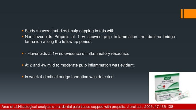 pulp capping agents direct pulp cap