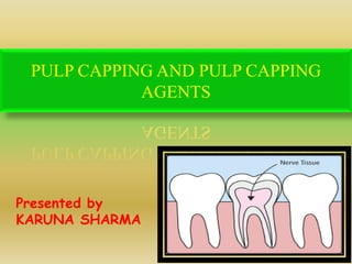 PULP CAPPING AND PULP CAPPING
AGENTS
Presented by
KARUNA SHARMA
 