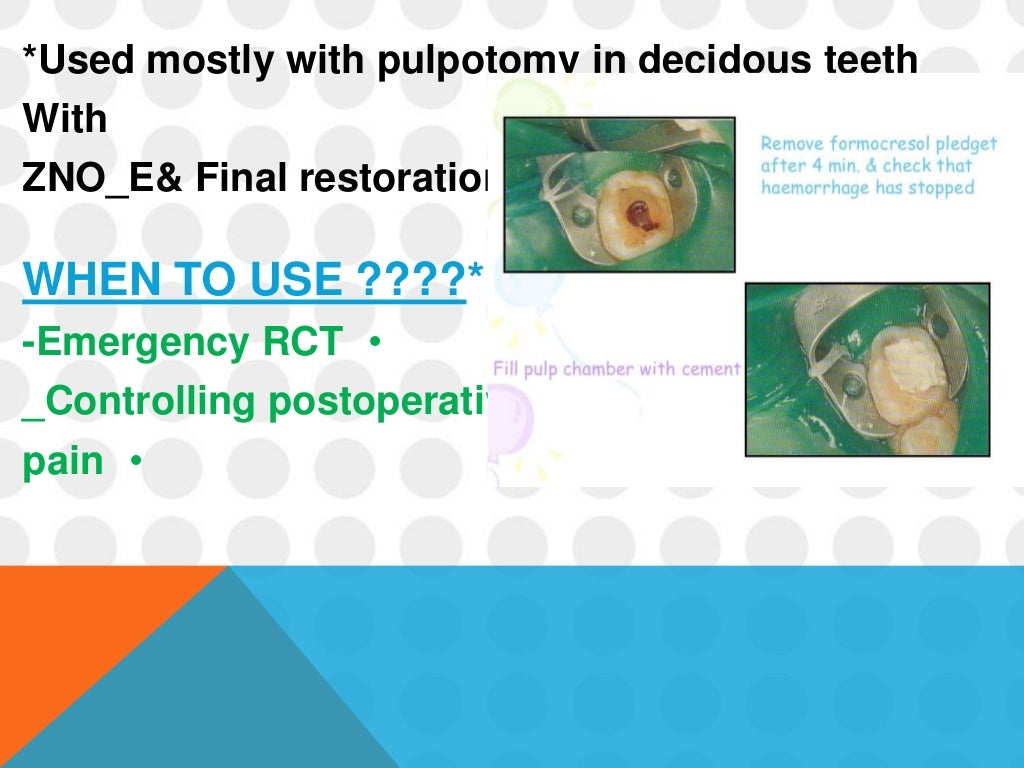 Pulp capping materials