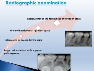 Large carious lesion with apparent
pulp exposure
Interrupted or broken lamina dura
Widened periodontal ligament space
Radiolucency at the root apices or furcation areas
 