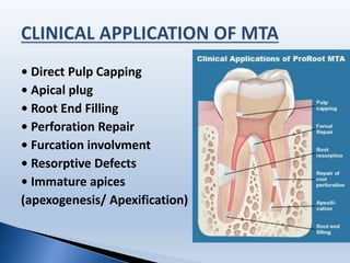 • Direct Pulp Capping
• Apical plug
• Root End Filling
• Perforation Repair
• Furcation involvment
• Resorptive Defects
• Immature apices
(apexogenesis/ Apexification)
 
