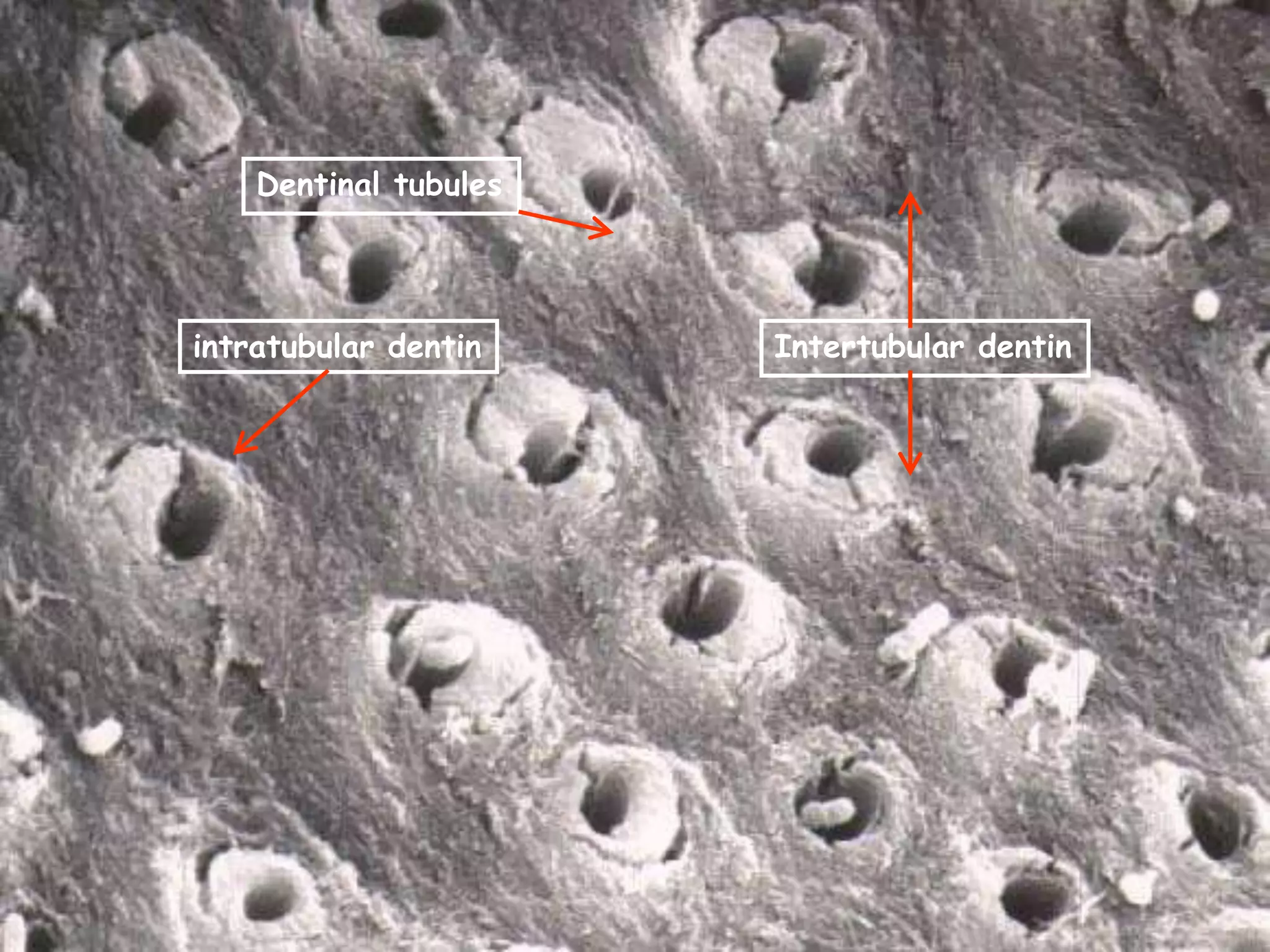 Pulp dentin complex | PPTX
