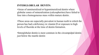 INTERGLOBULAR DENTIN:
•Areas of unmineralized or hypomineralized dentin where
globular zones of mineralization (calcospherites) have failed to
fuse into a homogeneous mass within mature dentin .
•These areas are especially prevalent in human teeth in which the
person has had a deficiency in vitamin D or exposure to high
levels of fluoride at the time of dentin formation.
•Interglobular dentin is most common in the circumpulpal dentin
just below the mantle dentin
 