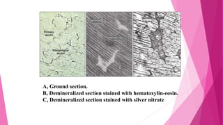 A, Ground section.
B, Demineralized section stained with hematoxylin-eosin.
C, Demineralized section stained with silver nitrate
 