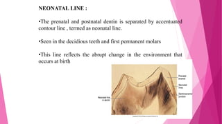 NEONATAL LINE :
•The prenatal and postnatal dentin is separated by accentuated
contour line , termed as neonatal line.
•Seen in the decidious teeth and first permanent molars
•This line reflects the abrupt change in the environment that
occurs at birth
 