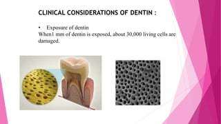 CLINICAL CONSIDERATIONS OF DENTIN :
• Exposure of dentin
When1 mm of dentin is exposed, about 30,000 living cells are
damaged.
 