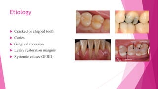 Etiology
 Cracked or chipped tooth
 Caries
 Gingival recession
 Leaky restoration margins
 Systemic causes-GERD
 