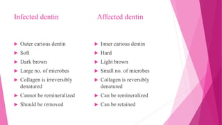 Infected dentin Affected dentin
 Outer carious dentin
 Soft
 Dark brown
 Large no. of microbes
 Collagen is irreversibly
denatured
 Cannot be remineralized
 Should be removed
 Inner carious dentin
 Hard
 Light brown
 Small no. of microbes
 Collagen is reversibly
denatured
 Can be remineralized
 Can be retained
 