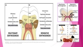 REFERENCE : Ten-Cate-Oral-Histology-Development-Structure-and-Function-9th-Edition-orbans-oral-histology-amp-
embryology Shafer's textbook of Oral pathology
 