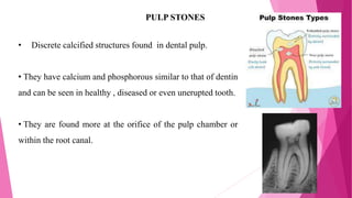 PULP STONES
• Discrete calcified structures found in dental pulp.
• They have calcium and phosphorous similar to that of dentin
and can be seen in healthy , diseased or even unerupted tooth.
• They are found more at the orifice of the pulp chamber or
within the root canal.
 