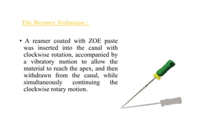 The Reamer Technique :
• A reamer coated with ZOE paste
was inserted into the canal with
clockwise rotation, accompanied by
a vibratory motion to allow the
material to reach the apex, and then
withdrawn from the canal, while
simultaneously continuing the
clockwise rotary motion.
 