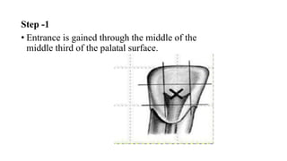 Step -1
• Entrance is gained through the middle of the
middle third of the palatal surface.
 