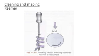 Cleaning and shaping
Reamer
 