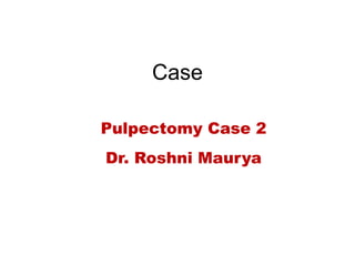 Case
Pulpectomy Case 2
Dr. Roshni Maurya
 
