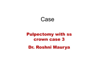 Case
Pulpectomy with ss
crown case 3
Dr. Roshni Maurya
 
