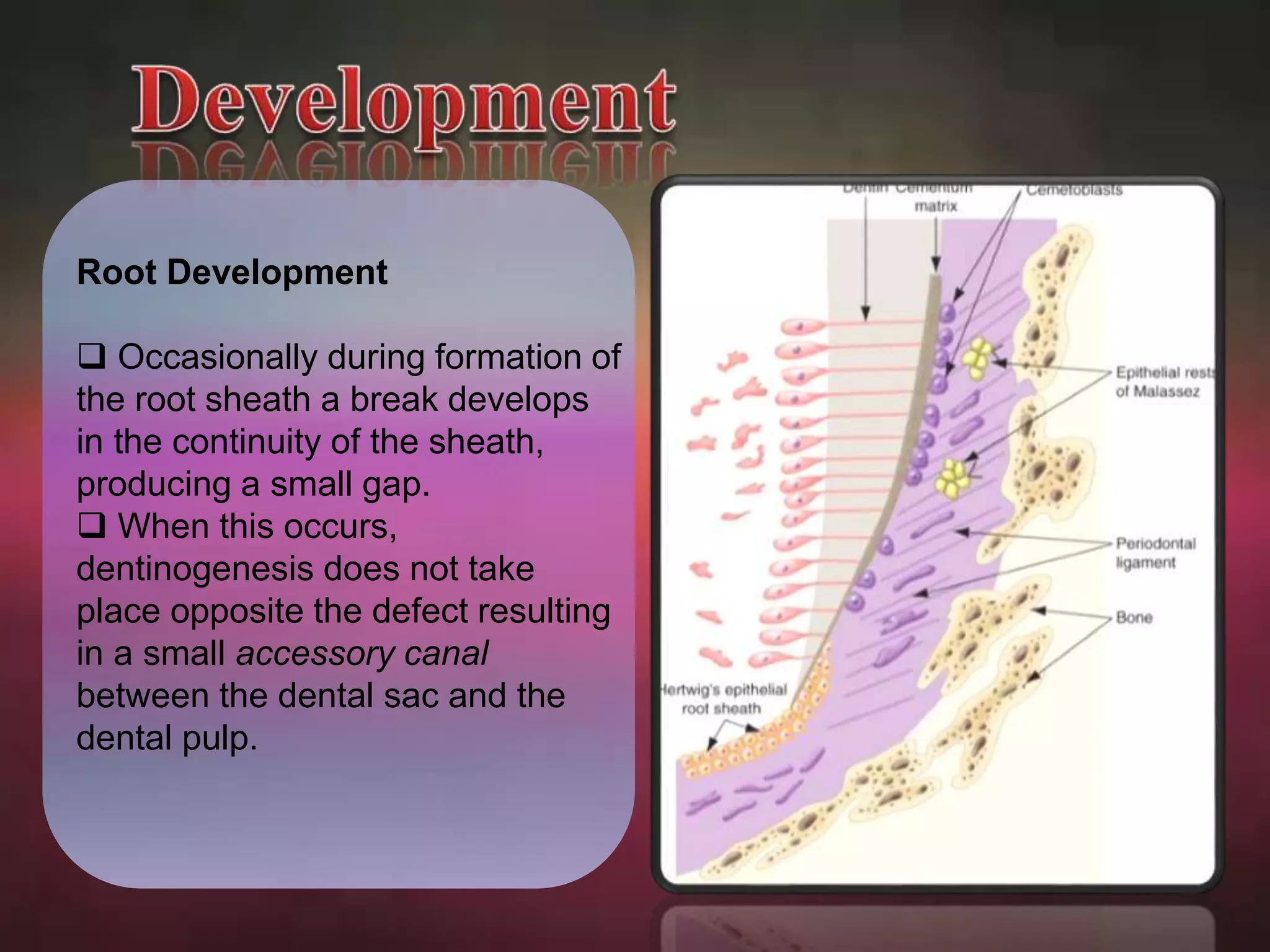Root Development 
 Occasionally during formation of 
the root sheath a break develops 
in the continuity of the sheath, 
producing a small gap. 
 When this occurs, 
dentinogenesis does not take 
place opposite the defect resulting 
in a small accessory canal 
between the dental sac and the 
dental pulp. 
 