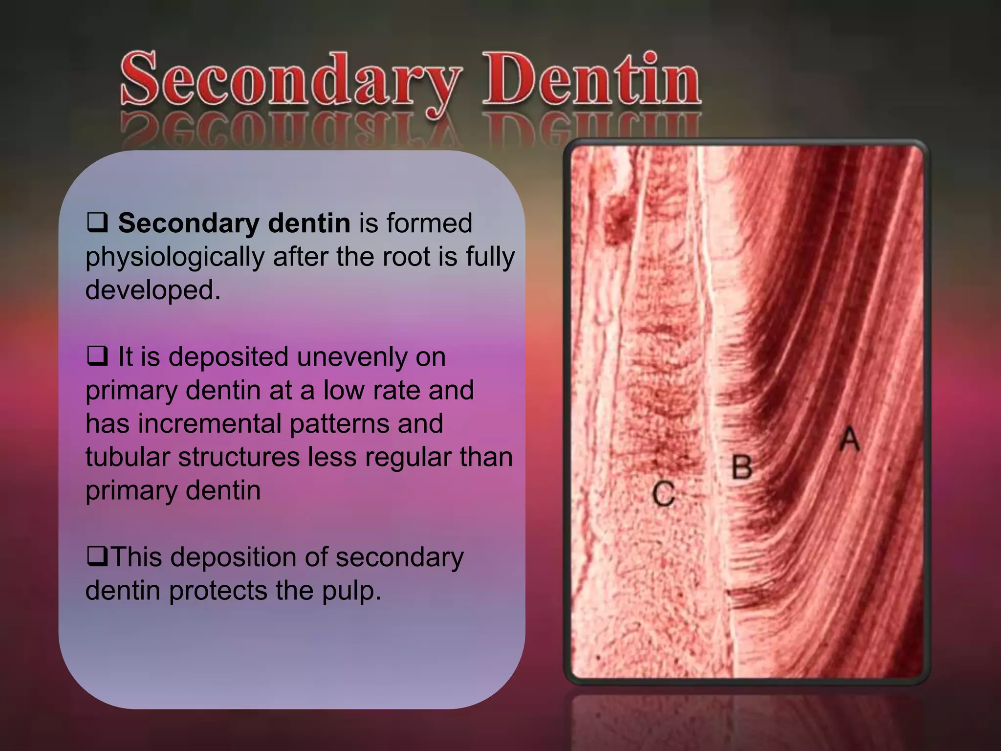 Secondary dentin is formed 
physiologically after the root is fully 
developed. 
 It is deposited unevenly on 
primary dentin at a low rate and 
has incremental patterns and 
tubular structures less regular than 
primary dentin 
This deposition of secondary 
dentin protects the pulp. 
 