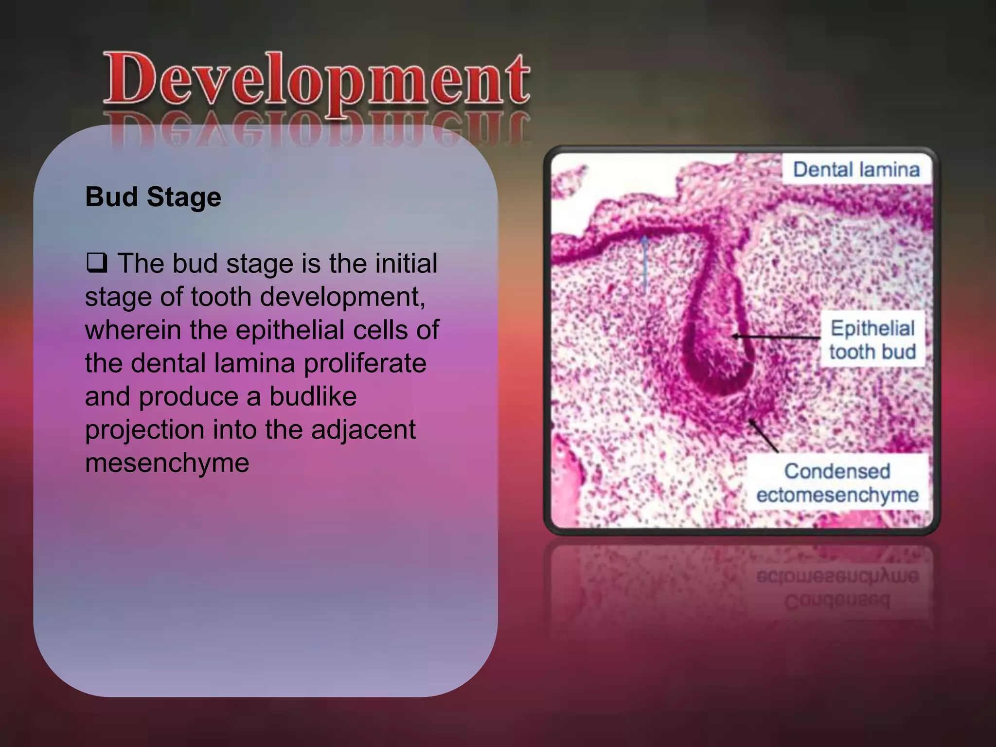 Bud Stage 
 The bud stage is the initial 
stage of tooth development, 
wherein the epithelial cells of 
the dental lamina proliferate 
and produce a budlike 
projection into the adjacent 
mesenchyme 
 