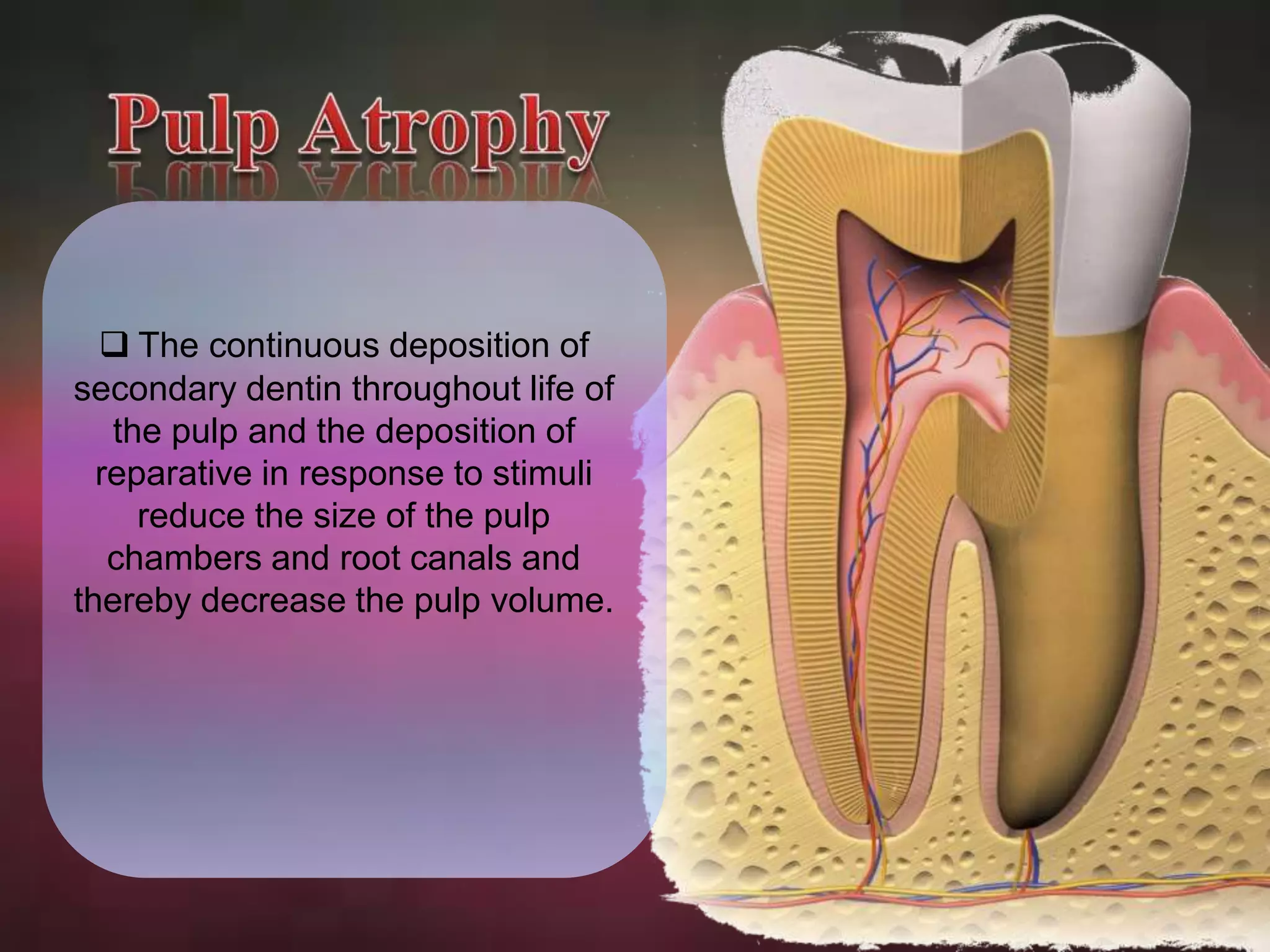  The continuous deposition of 
secondary dentin throughout life of 
the pulp and the deposition of 
reparative in response to stimuli 
reduce the size of the pulp 
chambers and root canals and 
thereby decrease the pulp volume. 
 