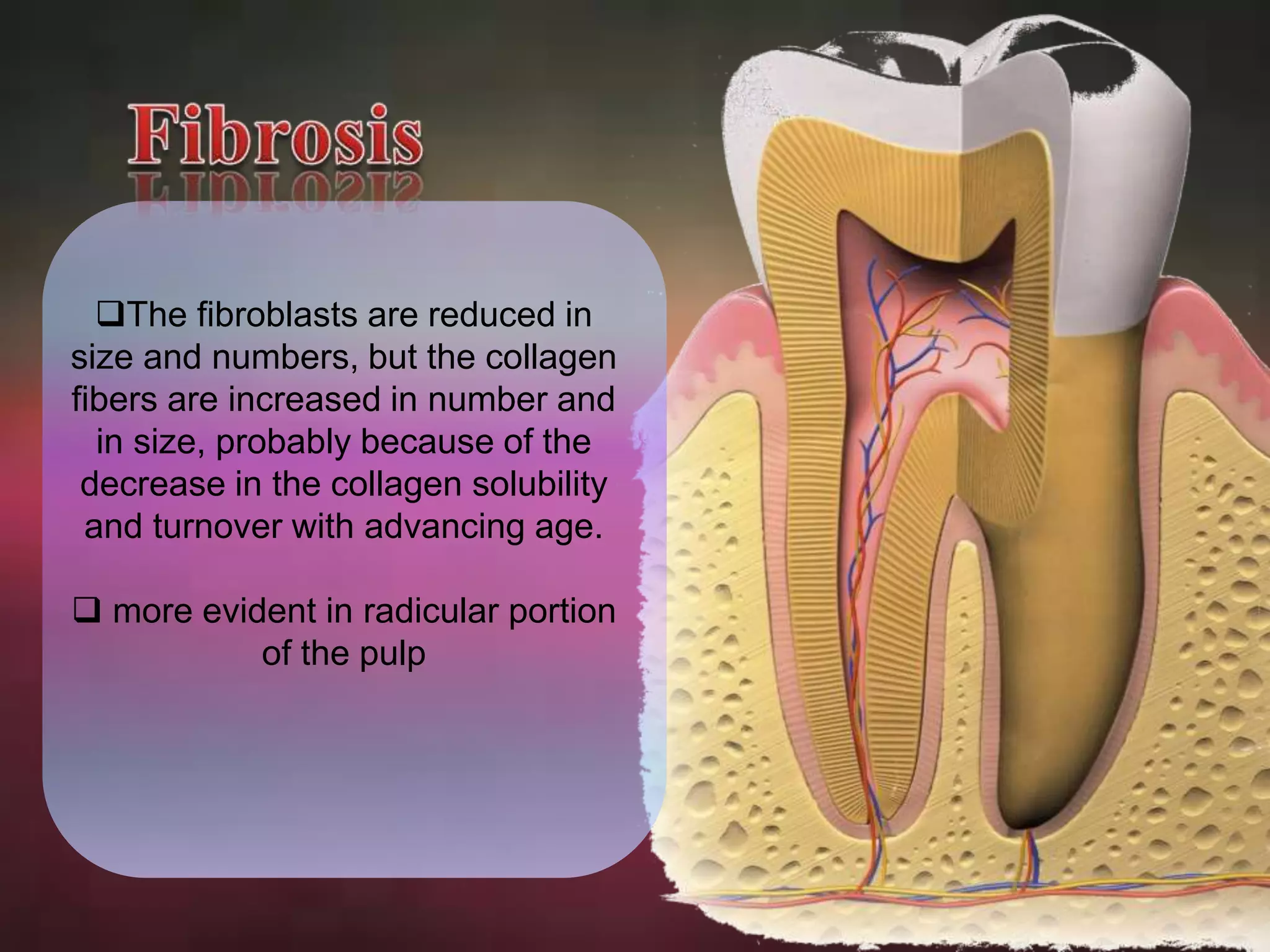 The fibroblasts are reduced in 
size and numbers, but the collagen 
fibers are increased in number and 
in size, probably because of the 
decrease in the collagen solubility 
and turnover with advancing age. 
 more evident in radicular portion 
of the pulp 
 