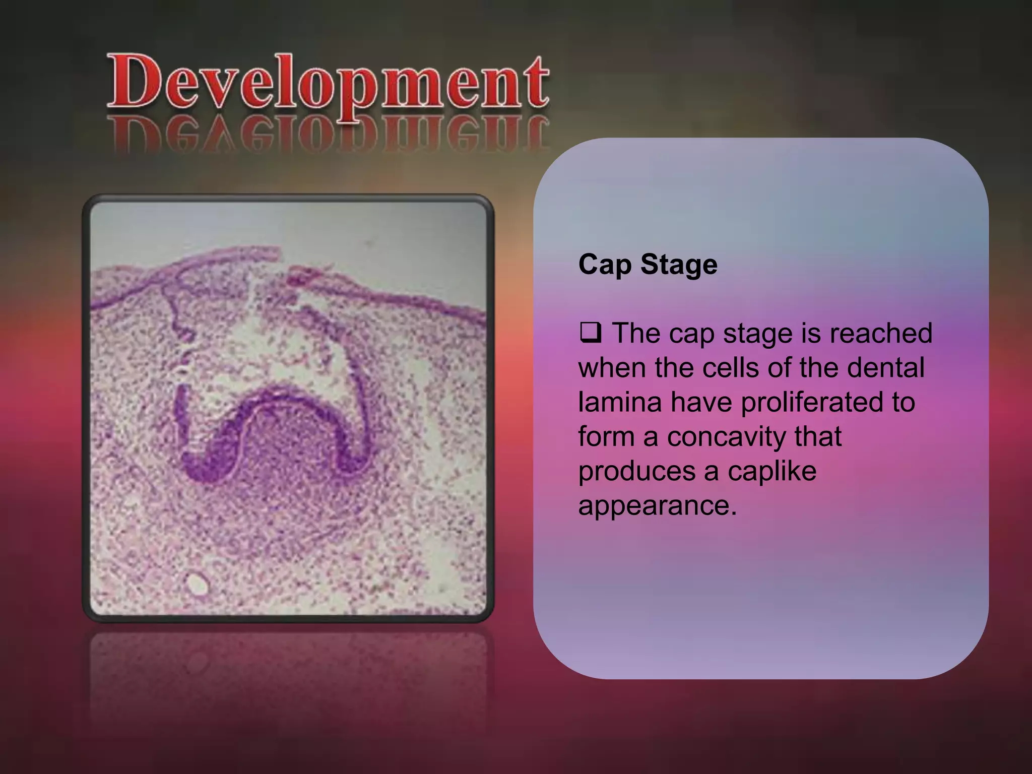 Cap Stage 
 The cap stage is reached 
when the cells of the dental 
lamina have proliferated to 
form a concavity that 
produces a caplike 
appearance. 
 