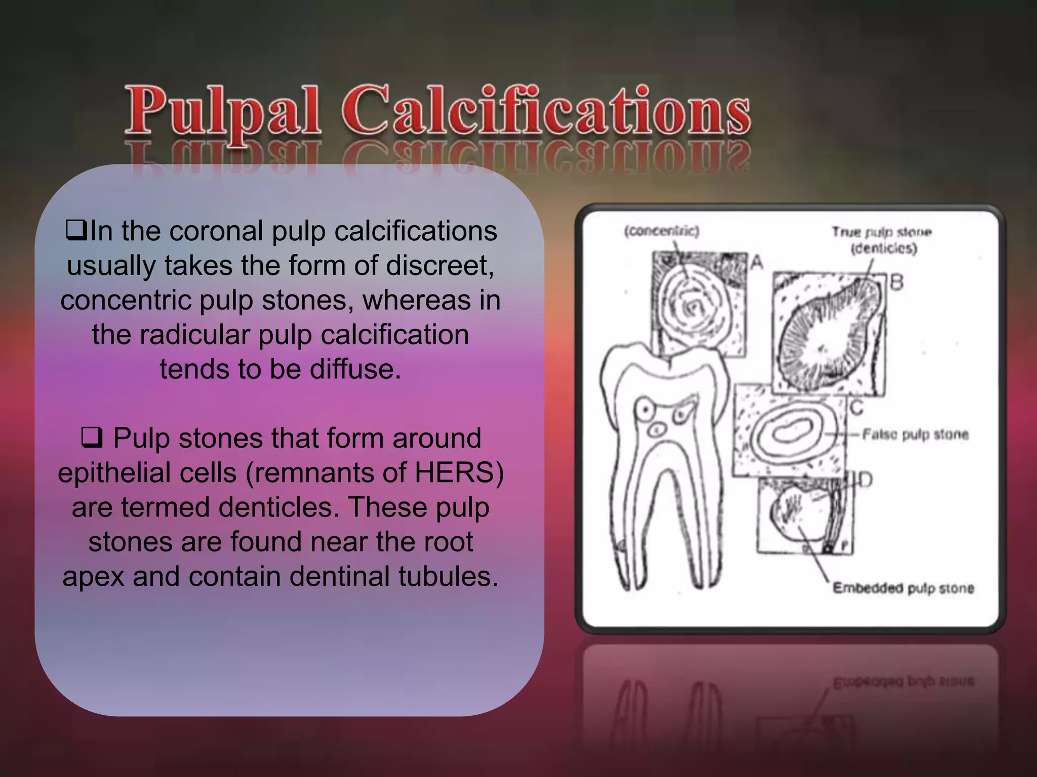 In the coronal pulp calcifications 
usually takes the form of discreet, 
concentric pulp stones, whereas in 
the radicular pulp calcification 
tends to be diffuse. 
 Pulp stones that form around 
epithelial cells (remnants of HERS) 
are termed denticles. These pulp 
stones are found near the root 
apex and contain dentinal tubules. 
 