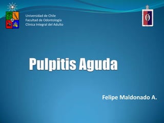 Felipe Maldonado A.
Universidad de Chile
Facultad de Odontología
Clínica Integral del Adulto
 