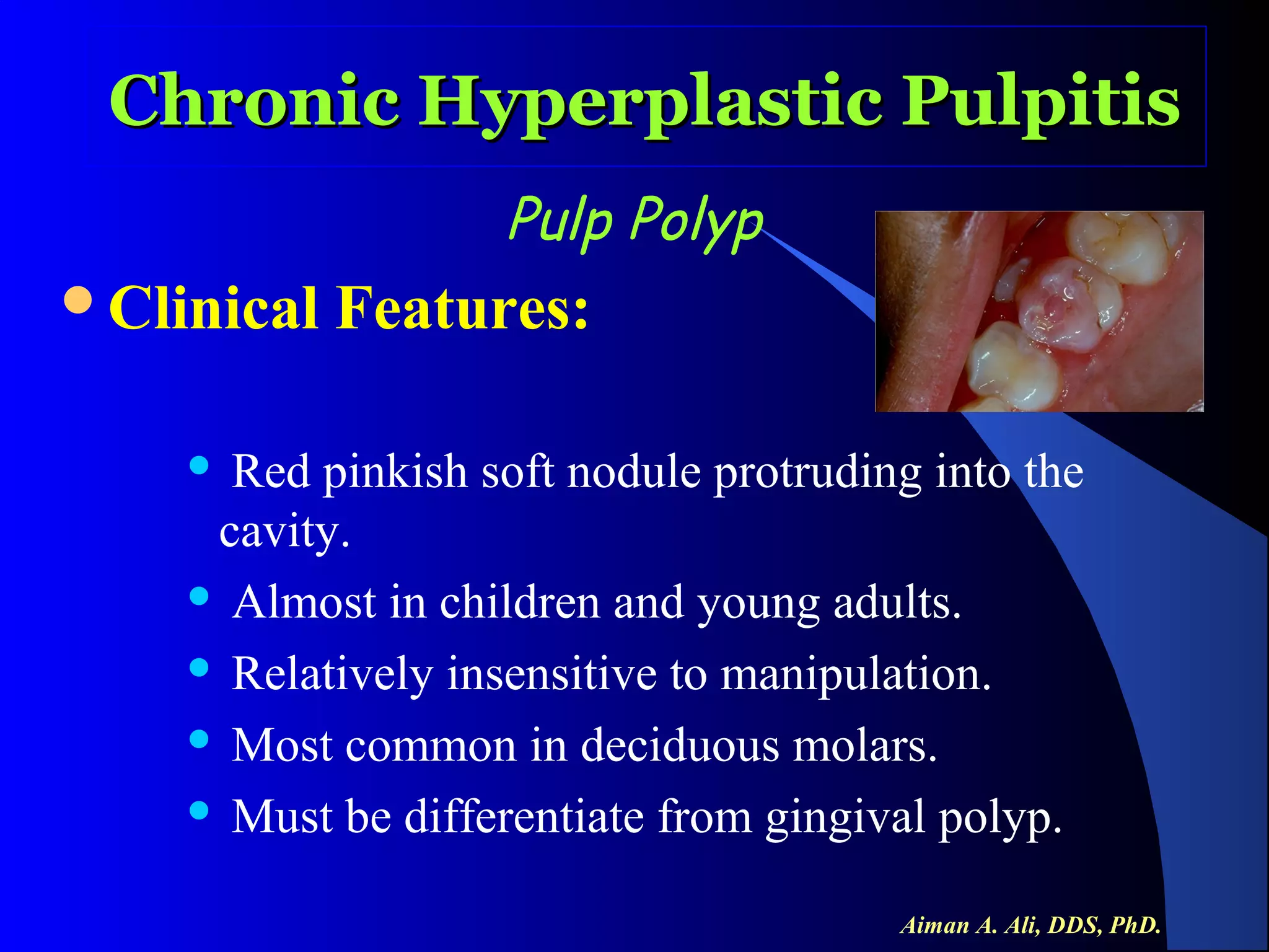 Chronic Hyperplastic Pulpitis
Pulp Polyp
Clinical

Features:

Red pinkish soft nodule protruding into the
cavity.
 Almost in children and young adults.
 Relatively insensitive to manipulation.
 Most common in deciduous molars.
 Must be differentiate from gingival polyp.


Aiman A. Ali, DDS, PhD.

 
