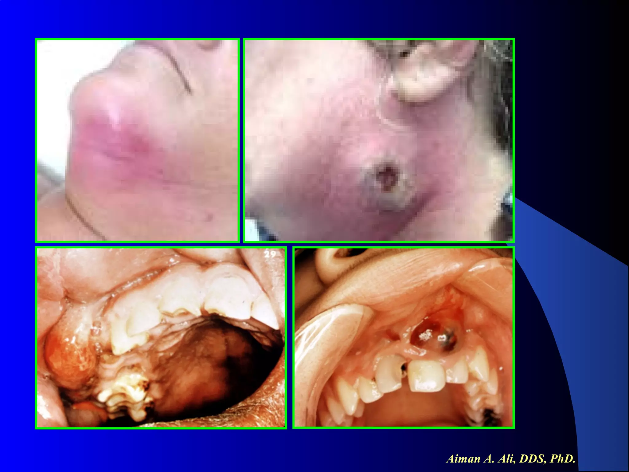 Aiman A. Ali, DDS, PhD.

 