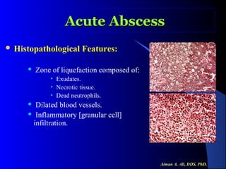 Acute Abscess
 Histopathological


Features:

Zone of liquefaction composed of:
• Exudates.
• Necrotic tissue.
• Dead neutrophils.

Dilated blood vessels.
 Inflammatory [granular cell]
infiltration.


Aiman A. Ali, DDS, PhD.

 