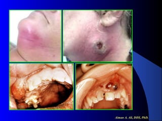 Aiman A. Ali, DDS, PhD.

 