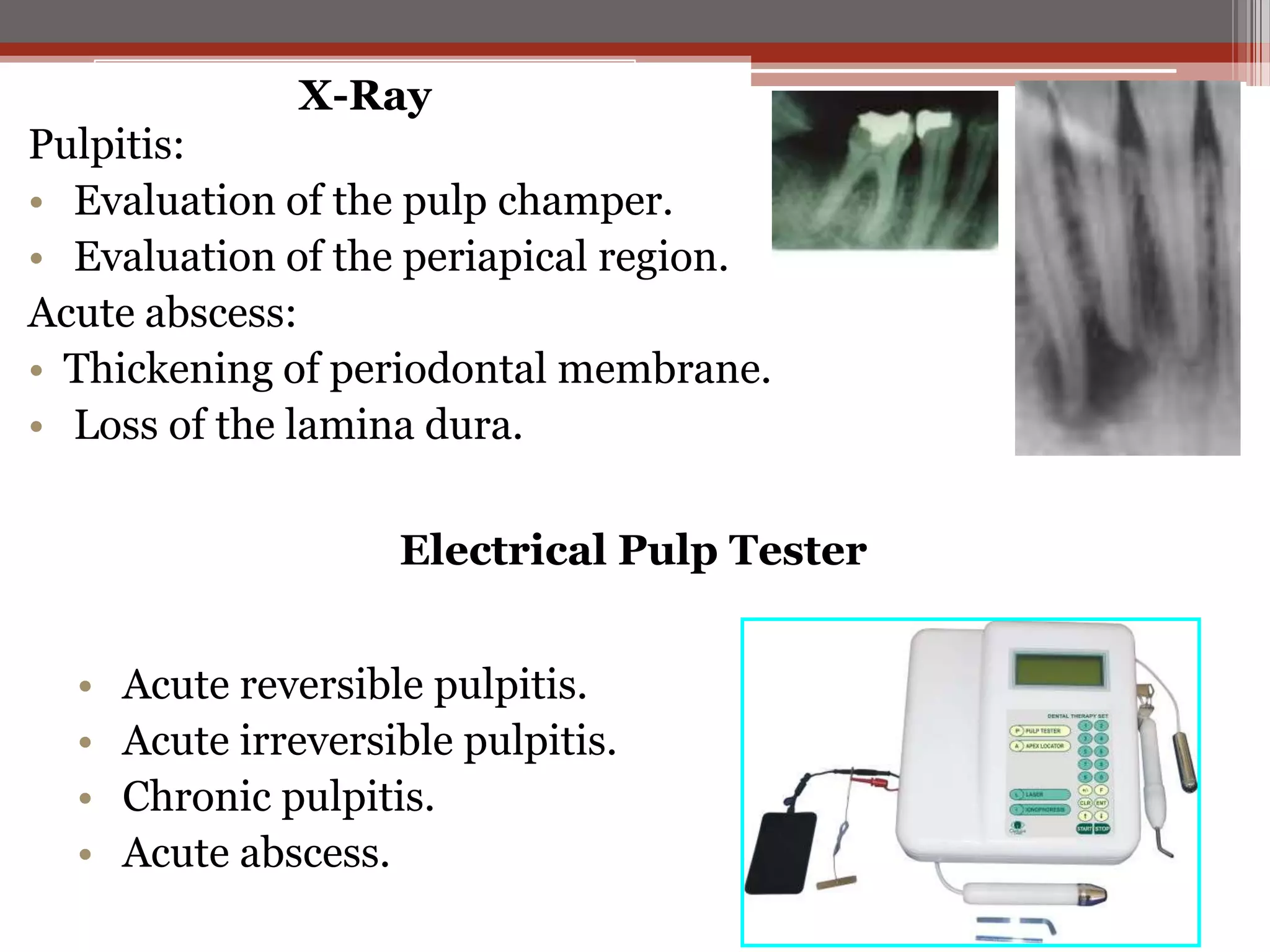 X-Ray

Pulpitis:
• Evaluation of the pulp champer.
• Evaluation of the periapical region.
Acute abscess:
• Thickening of periodontal membrane.
• Loss of the lamina dura.
Electrical Pulp Tester

•
•
•
•

Acute reversible pulpitis.
Acute irreversible pulpitis.
Chronic pulpitis.
Acute abscess.

 